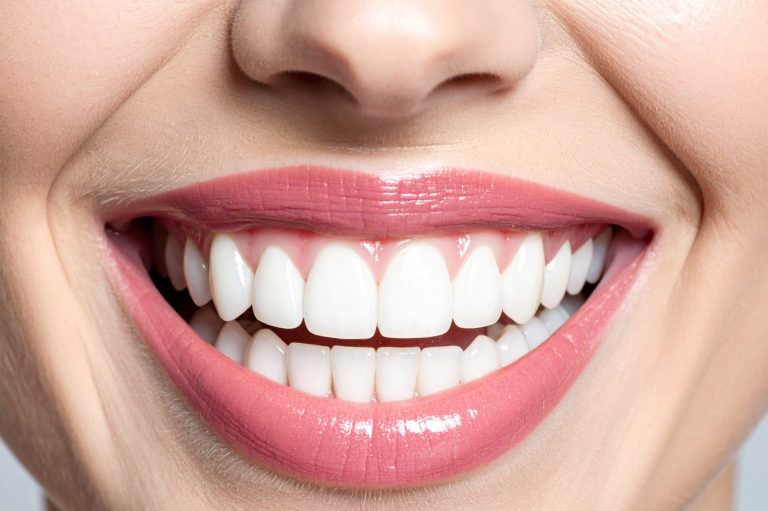 Lächelnde Person mit strahlend weißen Zähnen und gepflegtem Lippenstift.