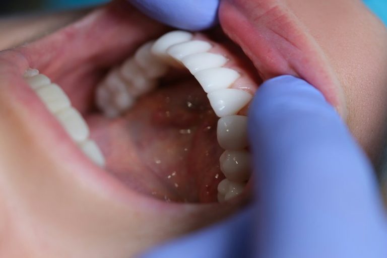 Mundraum mit Zähnen und Zahnfleisch, daumenfarbige Handschuhe sichtbar.